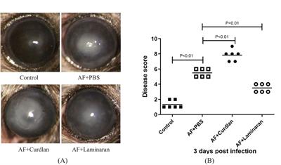 Dectin-1 participates in the immune-inflammatory response to mouse Aspergillus fumigatus keratitis by modulating macrophage polarization